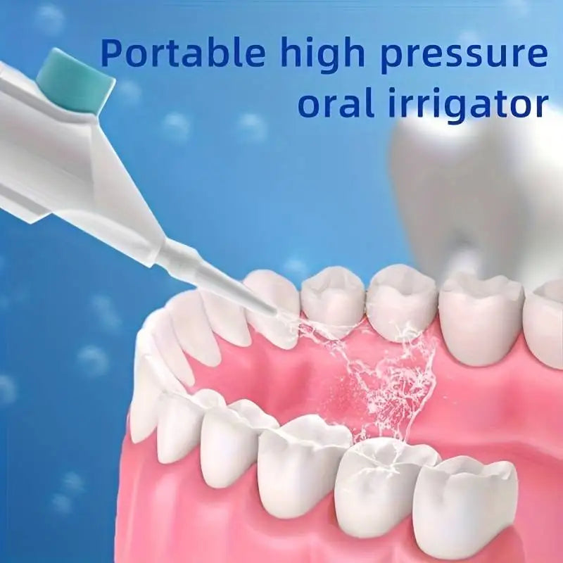 💧 Household High Pressure Oral Irrigator – Portable Dental Water Flosser
